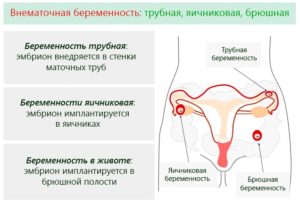 Кровянистые выделения 38 недель беременности после осмотра