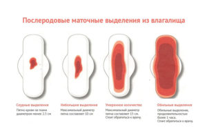 После родов выделения закончились через 2 недели после