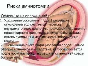 При беременности нарушение кровотока в пуповине