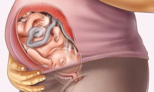 Беременность 36 37 недель предвестники родов форум