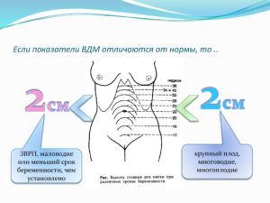 Высота дна матки на 14 неделе беременности