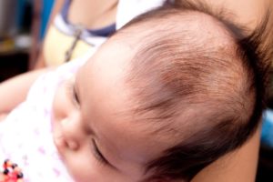 Ребенку 4 месяца выпадают волосы