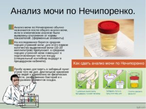 Как правильно сдавать мочу на анализ беременным