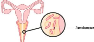 Гарднерелла у женщин симптомы и лечение при беременности