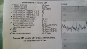 Как Подготовиться К Ктг При Беременности