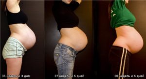 Фото опустился живот при беременности до и после