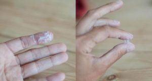 Желтые выделения после овуляции форум