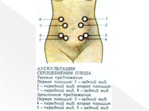 Можно ли почувствовать сердцебиение плода рукой на ранних сроках