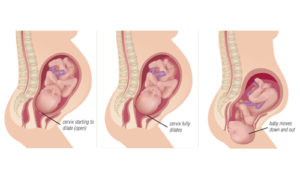 Раскрытие шейки матки на 1 палец на 40 неделе беременности когда роды