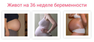36 Неделя беременности режущие боли
