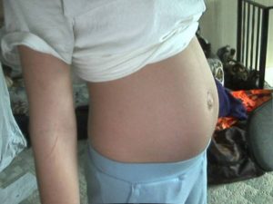 Беременность двойней 21 неделя фото