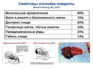 Отслойка плаценты на ранних сроках беременности причины и последствия