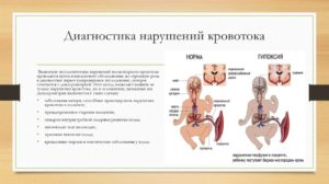 Нарушение кровотока 2 степени при беременности последствия для ребенка