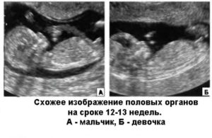 Можно ли на 13 неделе беременности определить пол ребенка на узи