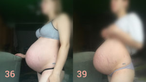 Не опускается живот 39 неделя беременности