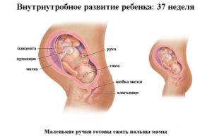 37 38 Недель беременности кесарево