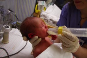 Как научить недоношенного ребенка есть из бутылочки после зонда