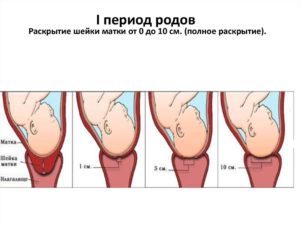 Мягкая шейка матки когда роды