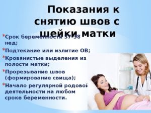 Снятие шва с шейки матки перед родами