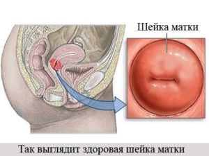 Можно ли достать пальцем до шейки матки при беременности