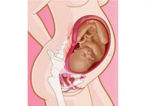 39 неделя беременности как быстрее родить и открыть шейку матки