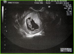 Беременность 4 недели фото плода на узи