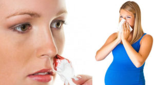 Признак беременности кровь из носа