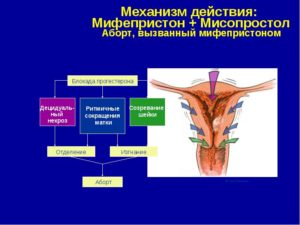 Через сколько начинает действовать мифепристон при стимуляции родов