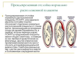 Отслойка плаценты на 8 неделе беременности причины и последствия