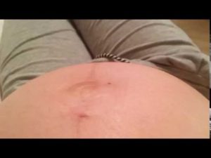 35 Неделя беременности икает