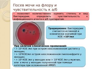 Микрофлора не выделена в моче что это значит