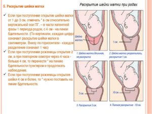 Если матка открылась на 1 палец когда рожать