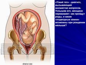 При беременности ребенок низко лежит