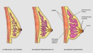 Болит ли грудь перед беременностью