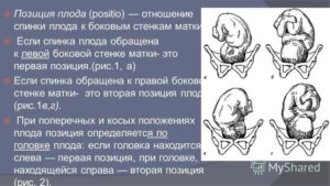 Положение плода продольное предлежание головное 1 позиция передний вид