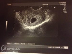 На узи не видно эмбриона 5 недель