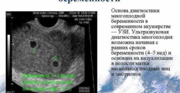 Признаки двойни на ранних сроках беременности без узи форум