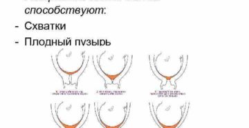 Шейка матки готова к родам а схваток нет что делать