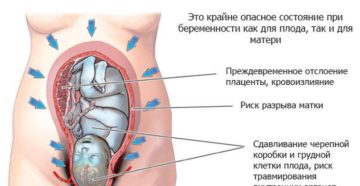 Тонус матки на 32 неделе беременности опасно ли это