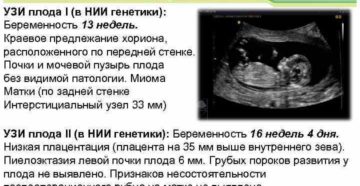 Краевое предлежание хориона 12 недель что это
