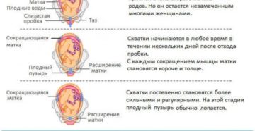 В какое время суток чаще всего начинаются схватки