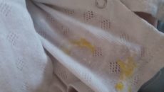 Новорожденный Ребенок Срыгивает Желтым Цветом После Кормления