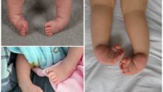 Когда выпрямятся ножки у новорожденного