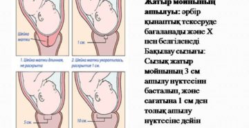 На 41 неделе беременности длинная шейка матки