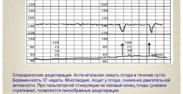 Как Подготовиться К Ктг При Беременности