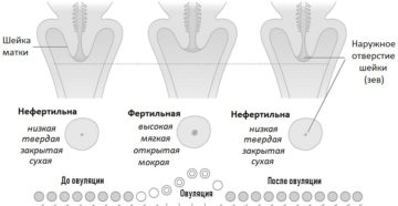 Твердая или мягкая матка при беременности