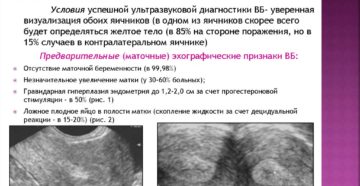 Можно Ли Определить На Узи Внематочную Беременность