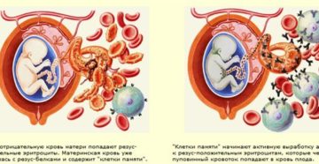 Беременность после 40 лет с отрицательным резусом