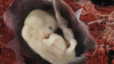 Эмбрион человека 7 недель фото