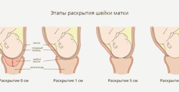 40 недель беременности а шейка матки не раскрывается